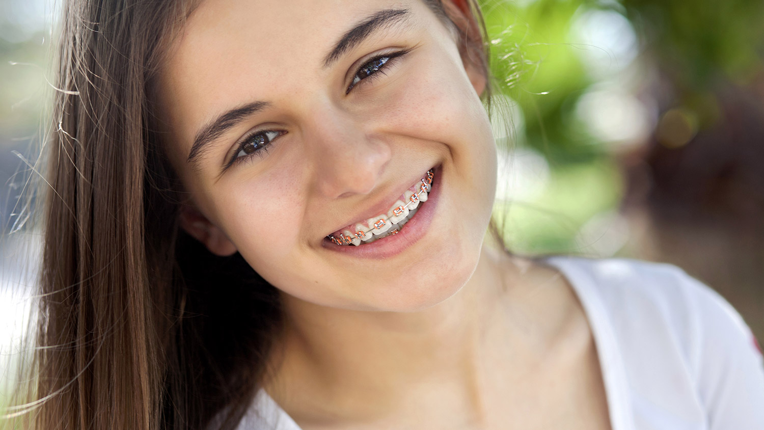 Orthodontics braces - Southern Dental Specialists
