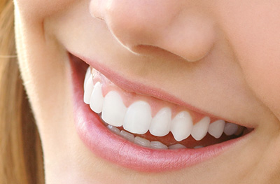 Southern Dental Specialists orthodontics Invisalign clear aligners